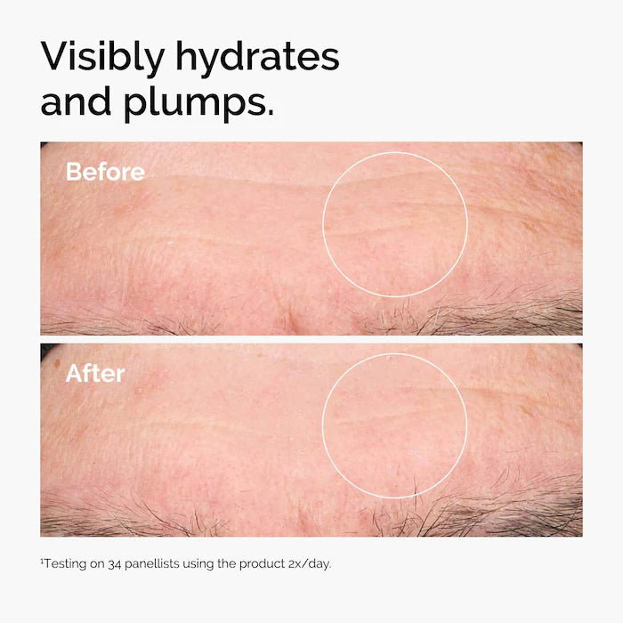 THE ORDINARY HYALURONIC ACID 2% + B5_30ml