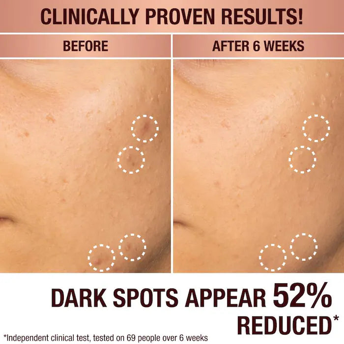 Charlotte Tilbury 
Dark Spot Correcting Radiance Recovery Serum-4.5ml