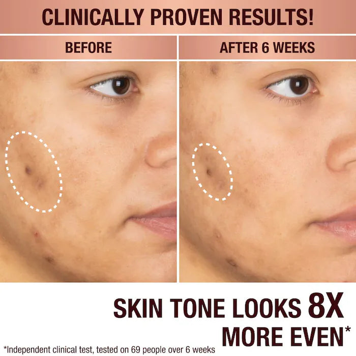 Charlotte Tilbury 
Dark Spot Correcting Radiance Recovery Serum-4.5ml