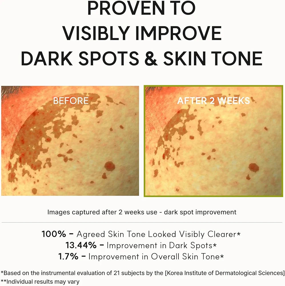 Arencia Vitamin C Booster Shot Serum with Glutathione, Niacinamide and Vitamin E for Dark Spot Care, Fine Lines & Wrinkles, Glass Skin, Korean Skincare 30ml