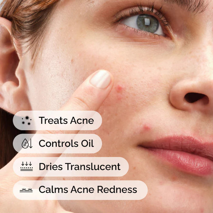 The Ordinary  Sulfur 10% Powder-to-Cream Concentrate Acne Spot Treatment- 5Ml