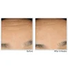 ROC RETINOL CORREXION NIGHT SERUM CAPSULES - Image 4