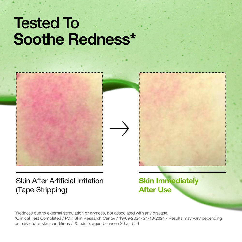 ANUA Azelaic Acid 10 Hyaluron Redness Soothing Serum - Image 4